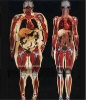 Снимок просканированного тела 115 килограммовой и 55 килограммовой девушки.jpg